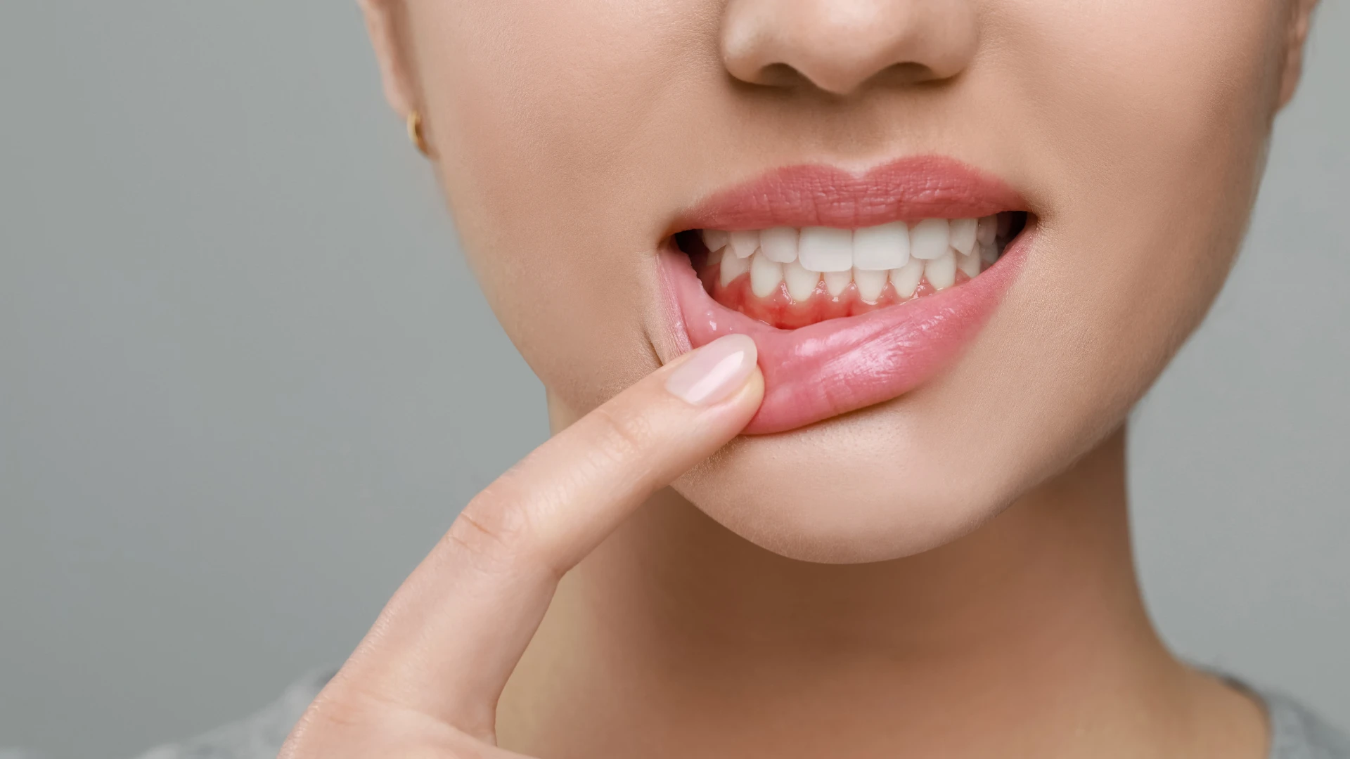 Healthy smile after gum disease treatment and periodontal care